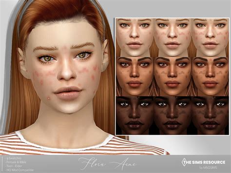 The Sims Resource - Flora Acne