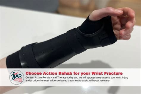 Distal Radius Fracture Treatment Action Rehab Hand Therapy
