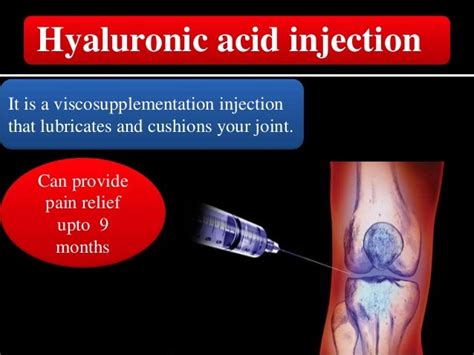 Intraartiular Knee Injection