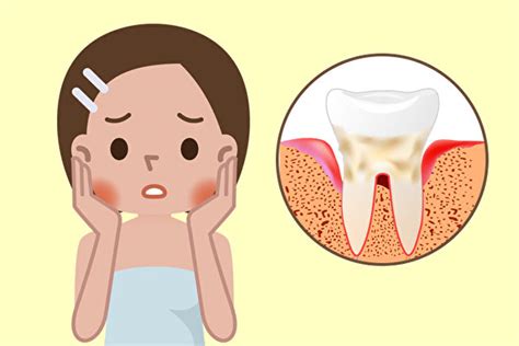 牙齦出血要留心 口腔 4 症狀可能是牙周病｜大紀元時報 香港｜獨立敢言的良心媒體