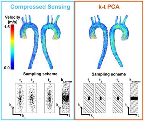 Pseudo Spiral Sampling And Compressed Sensing Reconstruction Provides