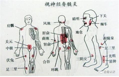 腰椎间盘突出推拿治疗手法及原理 知乎