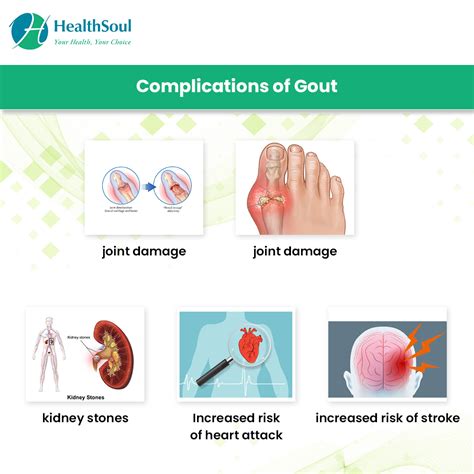 gout symptoms  overview gout  care icdk