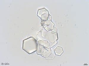 Cystinuria - Wikipedia