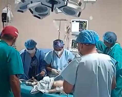 Médicos De Hospital De Emergencias Pediátricas Salvan En Arequipa A