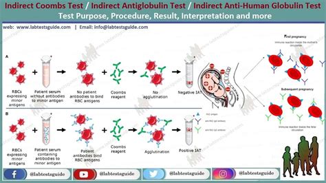 Indirect Coombs Test Procedure Result Interpretation And More Ltg