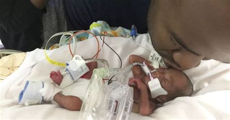 Miracle Baby Born 22 Weeks Early So Small He Could Wear Dads Wedding