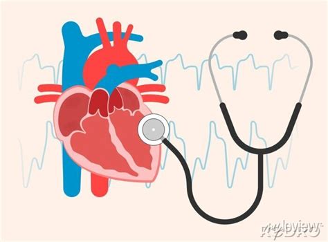 Cath Lab Atrial Septal Defect Tetralogy Of Fallot Patent Foramen Canvas