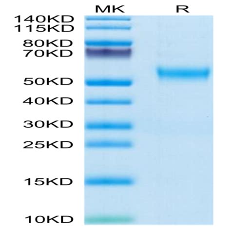 Human VSTM5 Protein (VSM-HM205) | KACTUS Biosystems | Ushelf