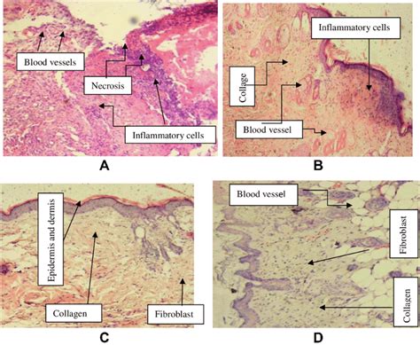 Images Of Histological Sections Of Burn Wound Tissue In The Crude