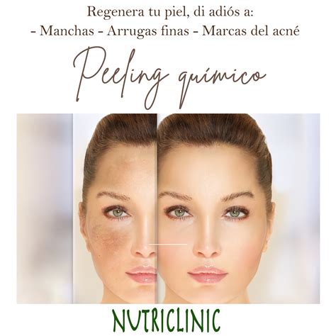 Peeling Qu Mico Facial