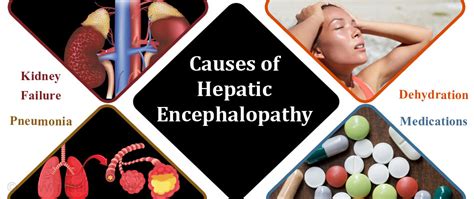 Causes Of Hepatic Encephalopathy