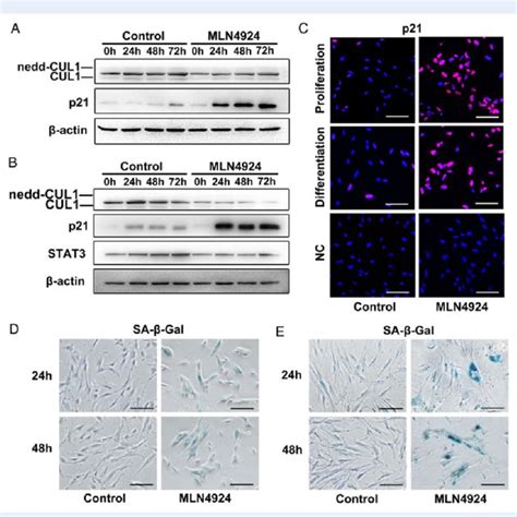 Neddylation Inhibition Induces P21 Accumulation Facilitating Cell