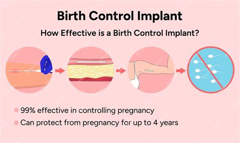 Premium Vector | Birth control implant information in vector