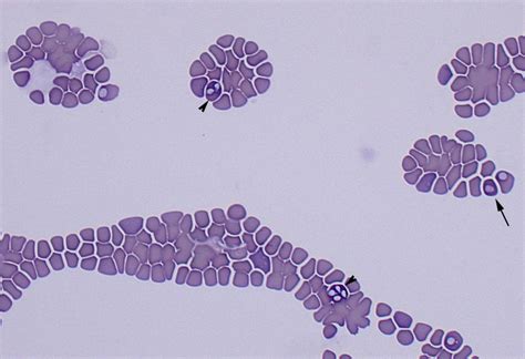 Infectious Agents Blood Eclinpath