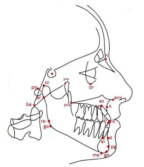 Cephalometric landmarks | Download Scientific Diagram