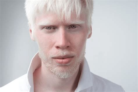 4,430 Albino Men Images, Stock Photos, 3D objects, & Vectors | Shutterstock