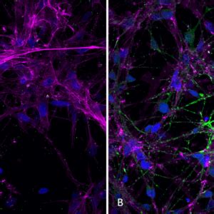 Human Alpha Synuclein Pre Formed Fibrils Type