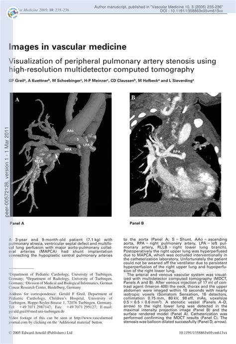 Pdf Visualization Of Peripheral Pulmonary Artery Stenosis Using High Resolution Multidetector