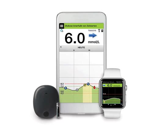 Eversense E Rtcgm System Mediq Direkt Diabetes