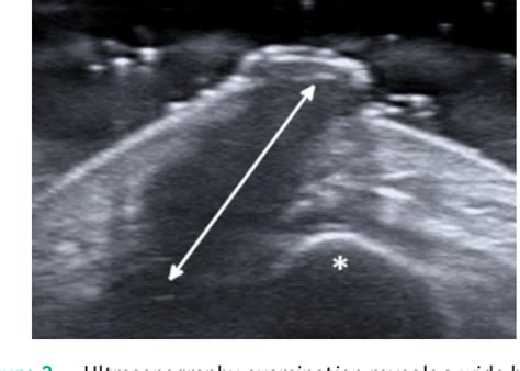 Figure From Usefulness Of High Frequency Ultrasonography In The