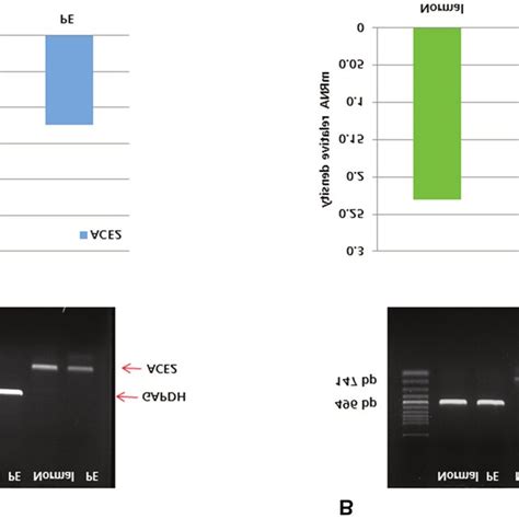 ACE2 Expression In Human PE Placental Tissue A High Cytoplasmic And