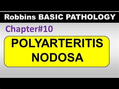 Ch Polyarteritis Nodosa Blood Vessel Pathology Robbins Lectures