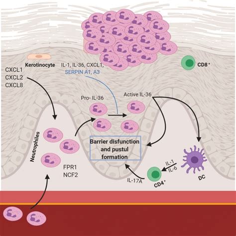 Pathophysiology In Pustular Psoriasis Download Scientific Diagram