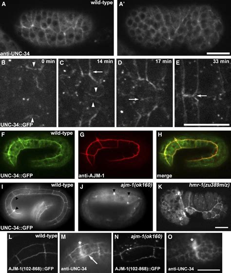 Unc Localizes To The Leading Edge Of Cell Protrusions And To Apical