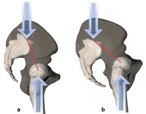 Scielo Brasil Sagittal Alignment Concepts And Spinopelvic Parameters Sagittal Alignment