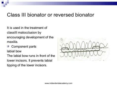 Bionator