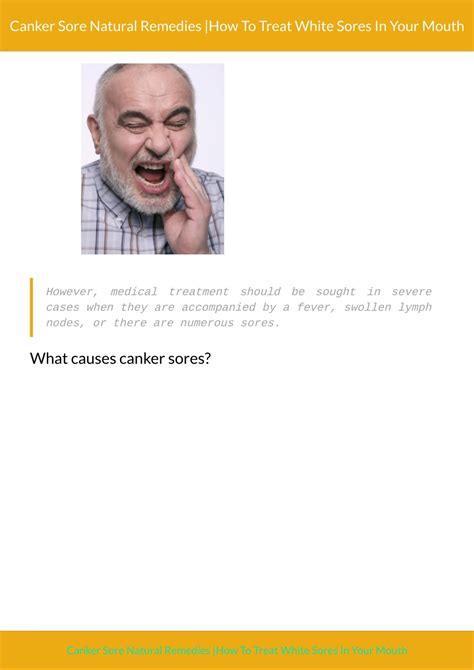 sore canker home remedy 10