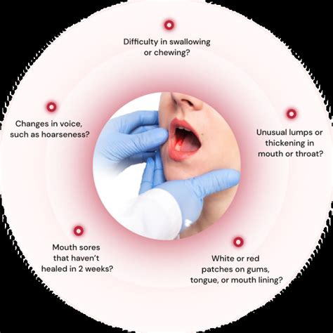 Oral Cancer Sahyadri Hospital