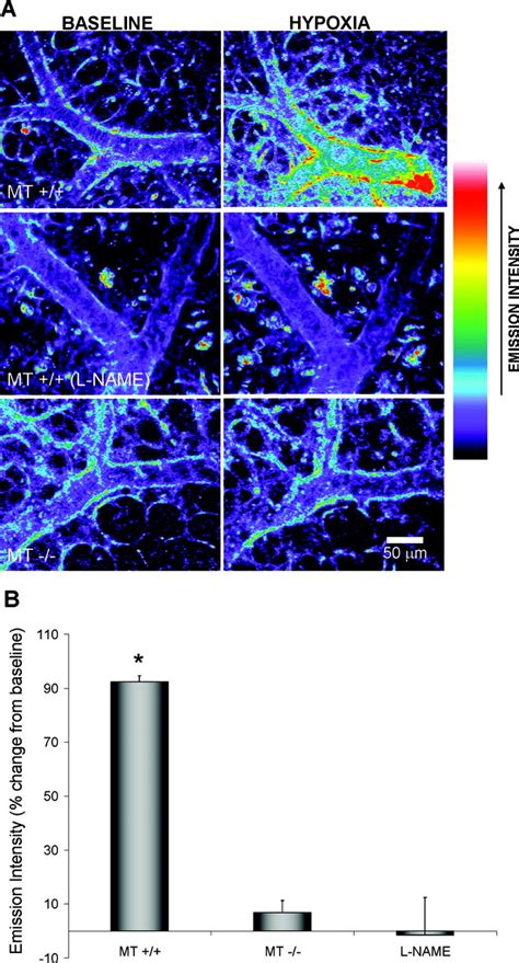 Nitric OxideMediated Zinc Release Contributes To Hypoxic Regulation Of