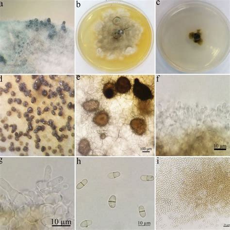 Petriella Sordida A Colony On Pda B Perithecia On Cla C Synnema