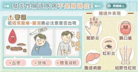 長期腹痛、腹瀉竟不是腸躁症？醫揭「發炎性腸道疾病」併發症超多uho優活健康網