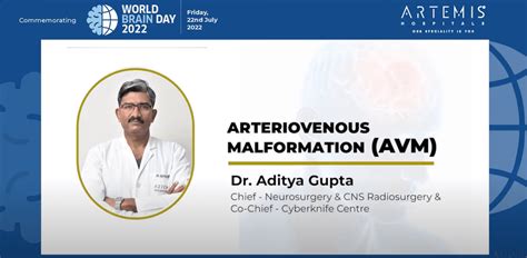 avm surgery  india arteriovenous malformation treatment