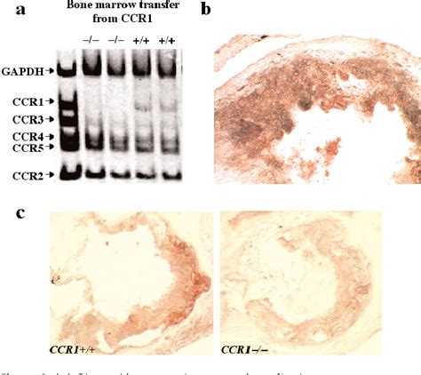 Figure 1 From Chemokine Receptor Ccr1 Disruption In Bone Marrow Cells