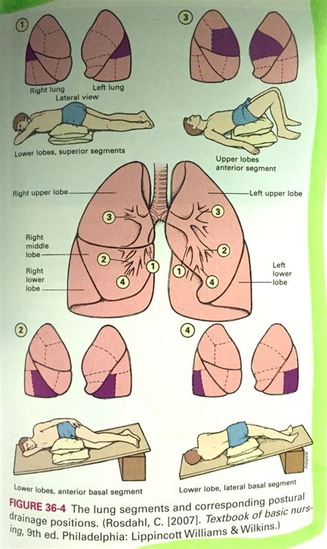 Postural Drainage Positions Respiratory Therapy Physical Therapy Lvn School