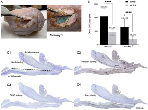 Frontiers Chronic Subdural Electrocorticography In Nonhuman Primates