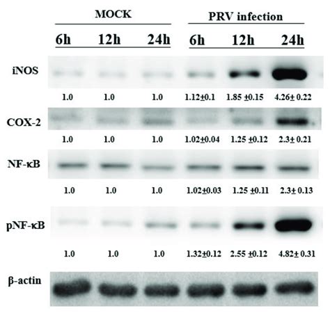 The Inos Cox 2 And Nf κb P65 Expression In Non Or Prv Infected Bv 2