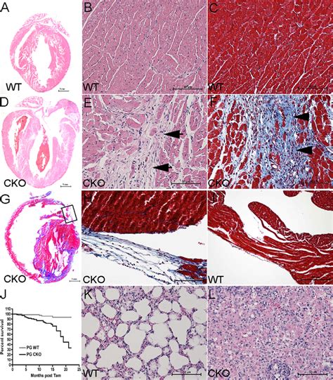 Histological Analysis Of PG CKO Mice Heart And Lung Sections From PG