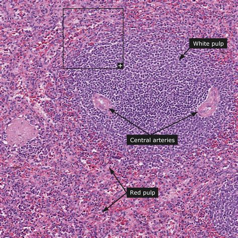 Lymphatic Histology Pulp Labeled Sexiz Pix