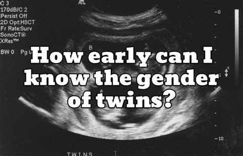 How early can I know the gender of twins? | LaptrinhX / News