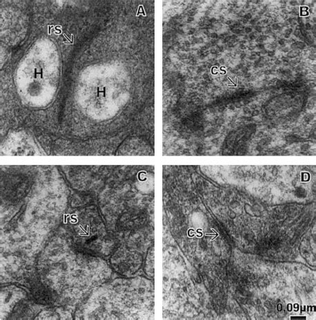 Electron Micrograph Of Synaptic Contacts In A P0 Rat Retina After 14