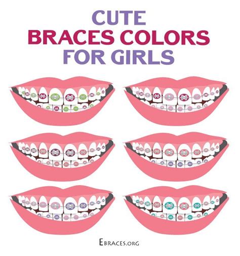 You Don't Have to Be a Genius to Choose Braces Colors