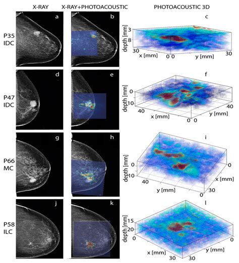 Applied Sciences Free Full Text Photoacoustic Imaging For