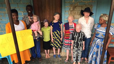 Fundraiser By Estel Call Help Children With Albinism In Uganda