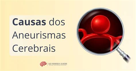 Aneurismas Cerebrais O Que Causa Sintomas E Tratamentos