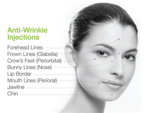 Anti Wrinkle Injections Dentalimplantindia